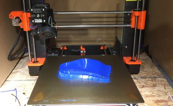 3D Printed Orthotics Tutorial