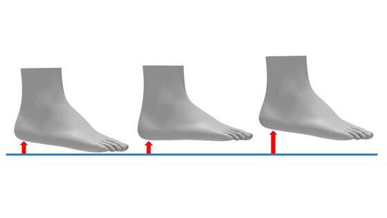 Elevating the foot for leg length descrepancies