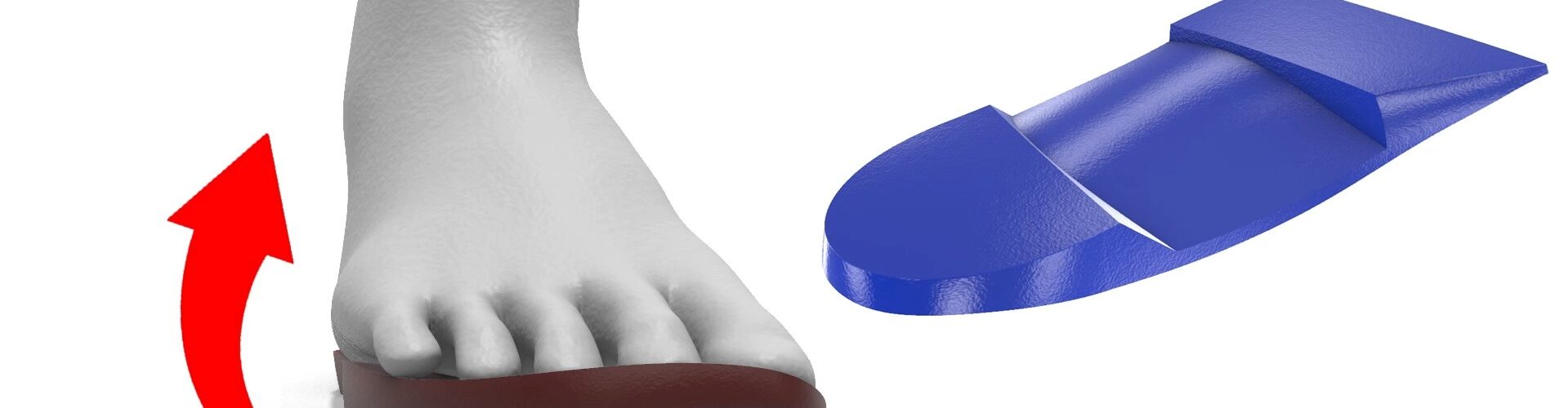 Foot Orthosis Twists and Posting