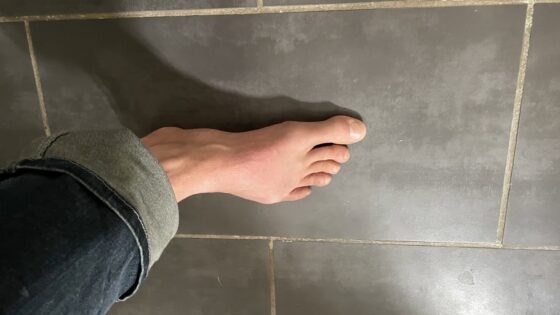 Shoe Last Fit Customization Case Study