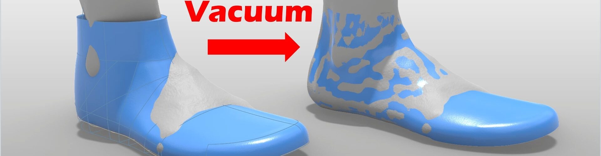 Vacuum Forming Shoe Lasts for Custom Orthopedic Shoemaking