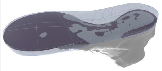 Vacuum Forming Orthotics Digitally