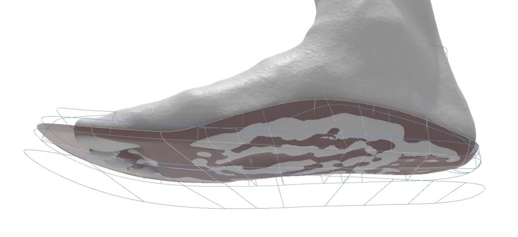 Vacuum forming sandal foot bed to foot model for custom 3D printing
